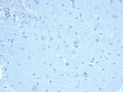 FoxP1 Antibody (FOXP1/44R) - Azide and BSA Free, Novus Biologicals 100 &mu;g | Buy Online | Novus Biologicals | Fisher Scientific